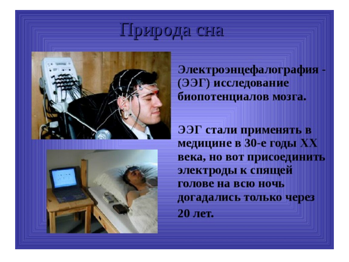 Ээг дневное ребенку. Электроэнцефалография сна. Электроэнцефалограф для сна. ЭЭГ сна. ЭЭГ дневного сна.