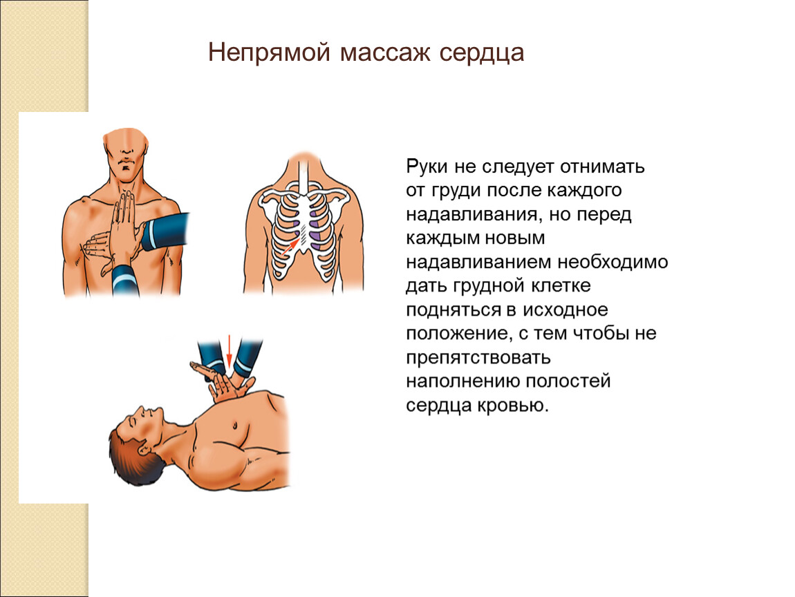 Начало подъема грудной клетки. Надавление на грудную клетку. При надавливании на грудную клетку больно. Не поднимается грудная клетка при дыхании. Место надавливания на грудную клетку при закрытом массаже сердца.