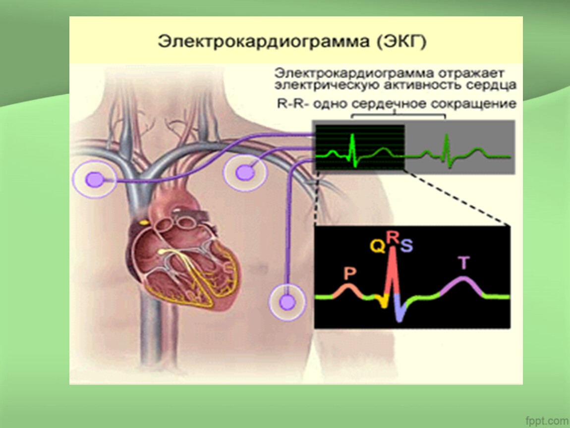 Стенокардия презентация казакша