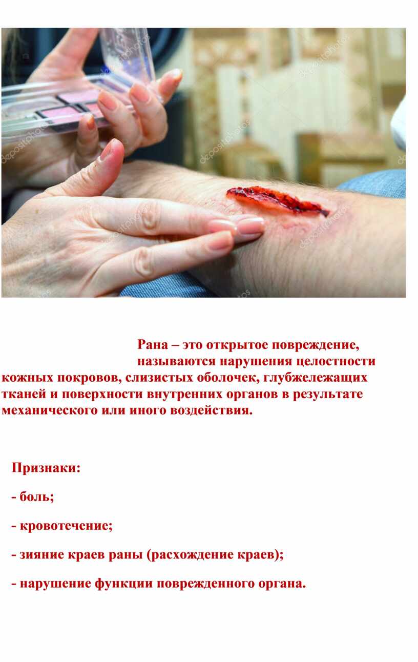 Рана – это открытое повреждение, называются нарушения целостности кожных покровов, слизистых оболочек, глубжележащих тканей и поверхности внутренних органов в результате механического или иного воздействия