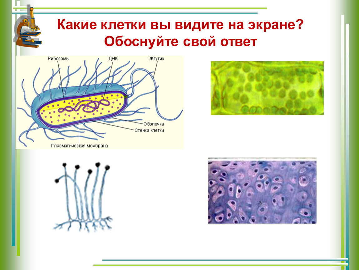 Прокариоты клеточной мембраны. Клетка прокариот. Прокариоты и эукариоты. Клетка бактерии прокариоты. Прокариотическая клетка виды.