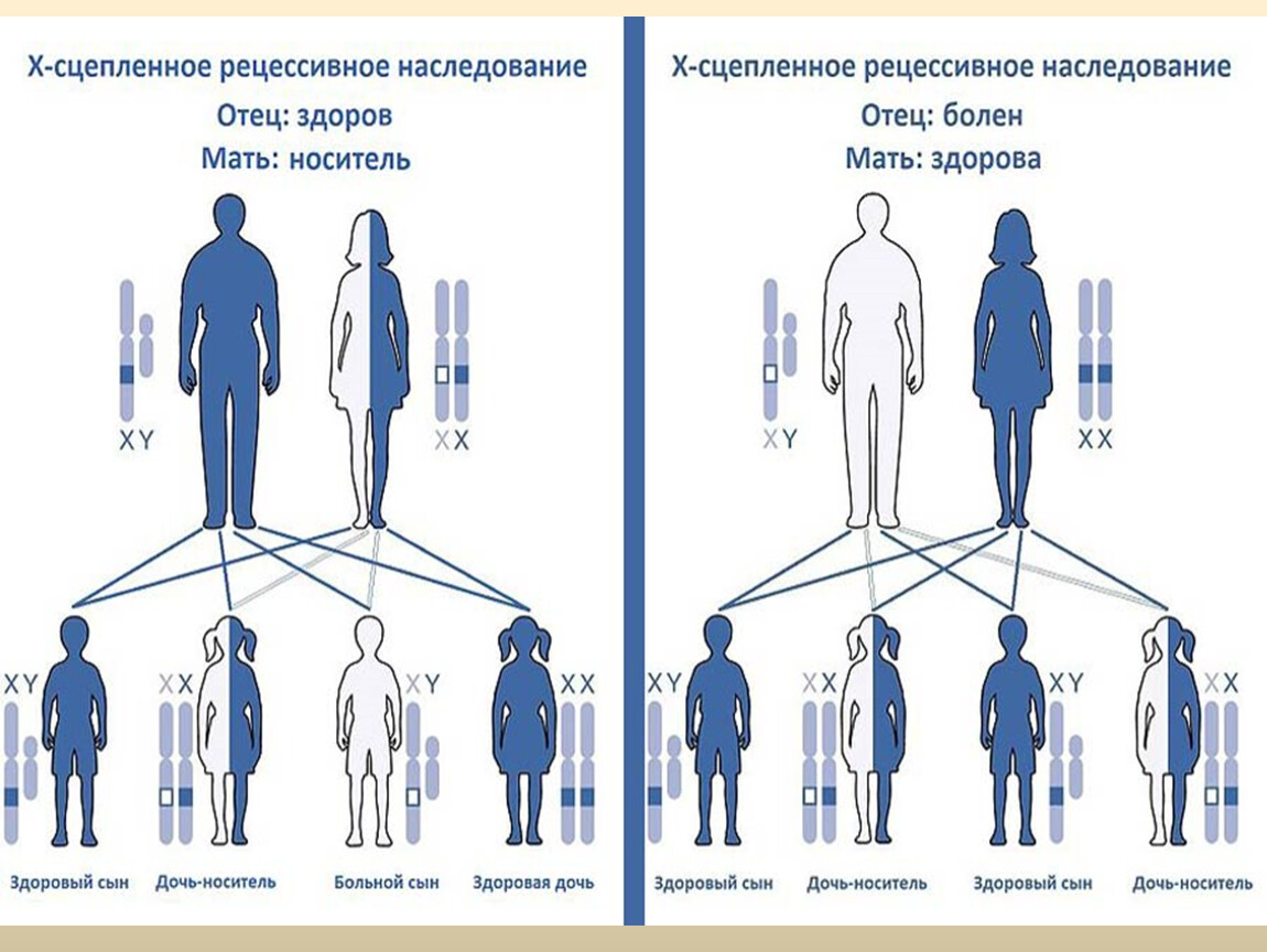 Папа гена мама. Схема наследования гемофилии и дальтонизма. Генетическая схема наследования сцепленное с полом. Схема наследования генетических заболеваний. Схема наследования сцепленных с полом заболеваний.