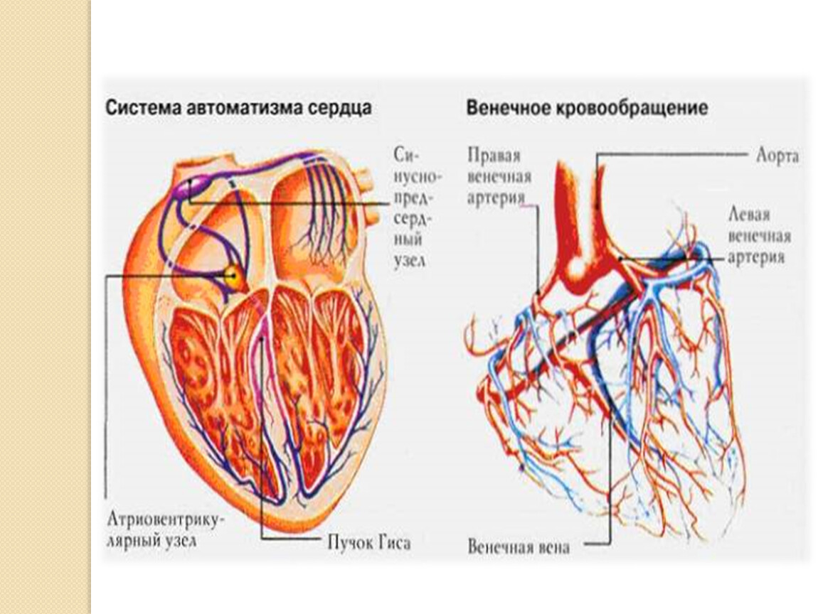 Острое сердце