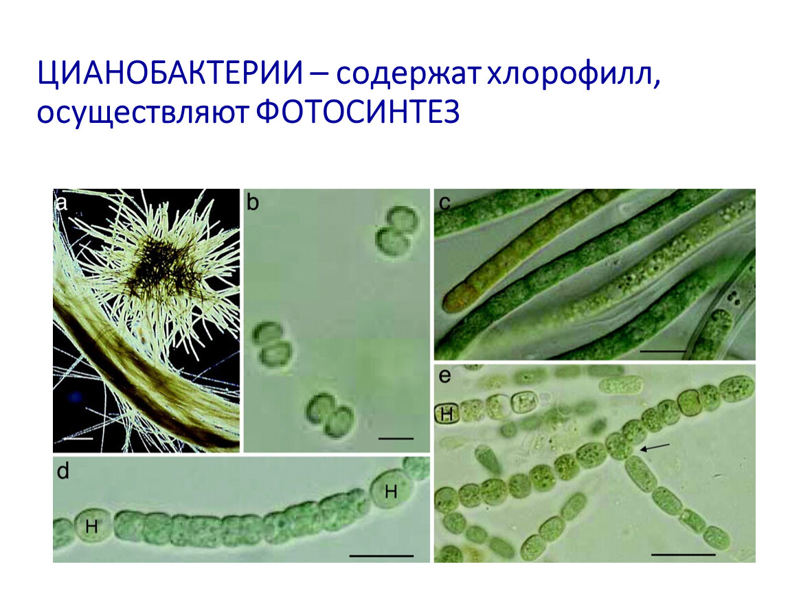 Хлорофилл цианобактерий. Цианобактерии фотосинтетики. Синезелёные водоросли цианобактерии. Цианобактерии хлорофилл. Фотосинтезируют цианобактерии.