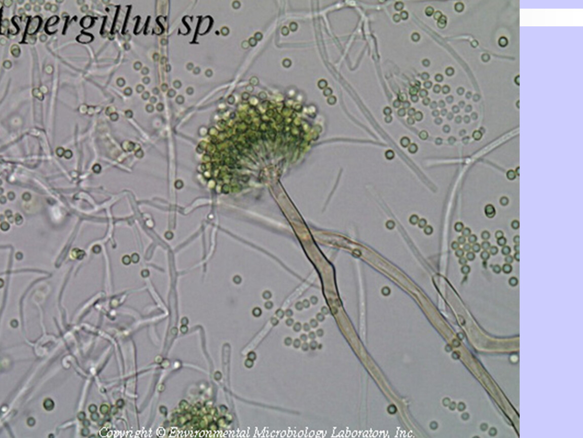 Обнаружены споры и мицелий. Aspergillus oryzae грибы. Aspergillus fumigatus микроскоп. Аспергилл кандида. Аспергилл мицелий под микроскопом.