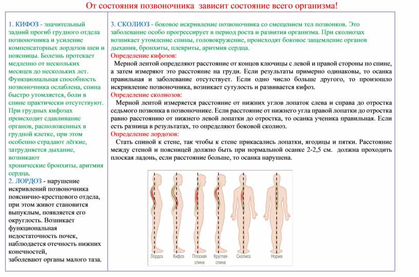 Перечислите нарушения осанки