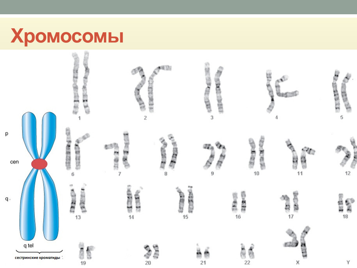 Хромосомы лучше видны. Хромосомы кариотип. Кариотип лимфоцитов крови. (Ге48) исследование кариотипа. Кариотип при патологии генетика.