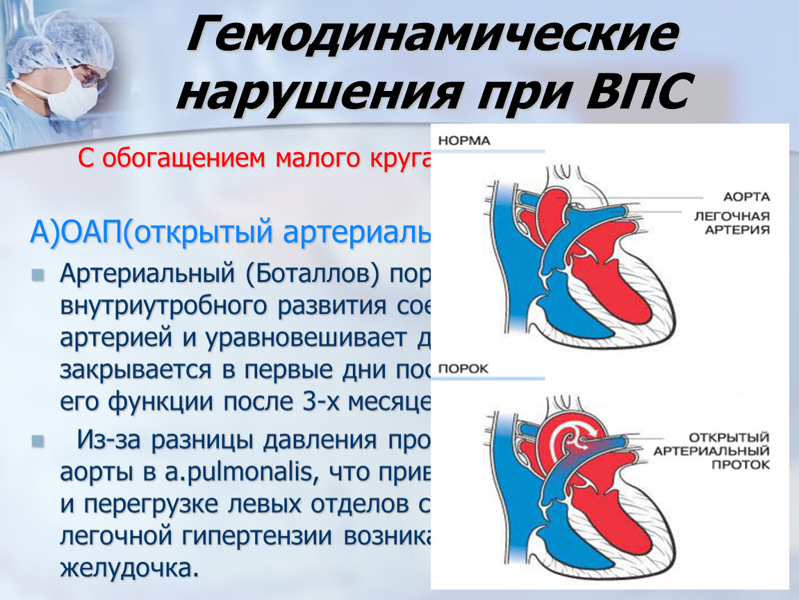 Обогащением малого круга кровообращения. Открытый артериальный проток нарушение гемодинамики. Порок открытый боталлов проток. ВПС открытый артериальный проток. Пороки сердца с обогащением малого круга кровообращения.