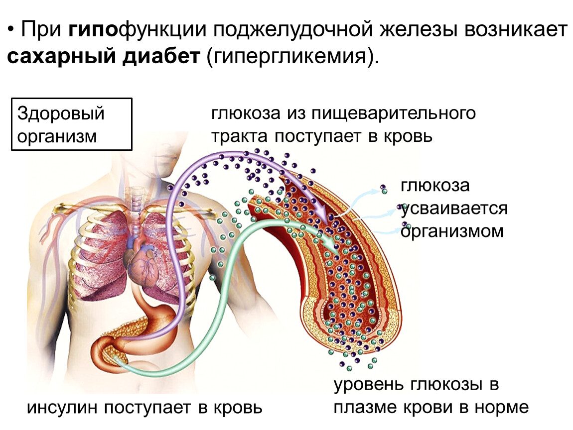 Поджелудочная железа и бронхолегочная система поражается при