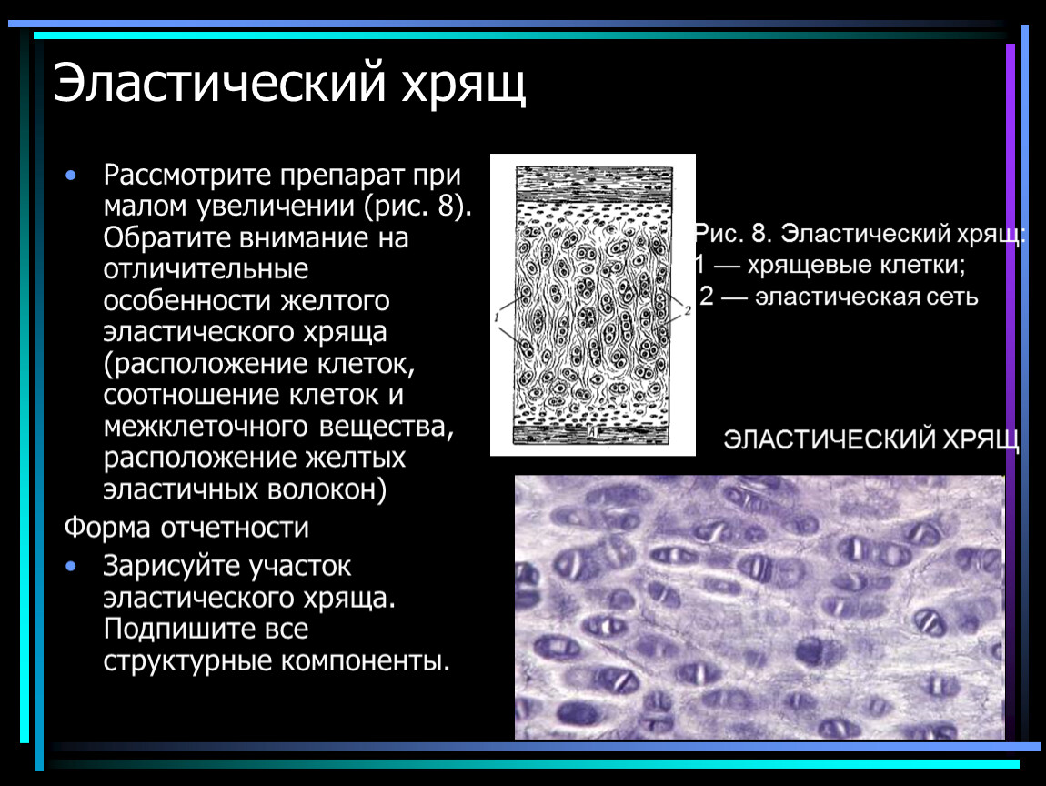 Способы роста хряща. Строение межклеточного вещества эластической хрящевой ткани. Строение эластического хряща препарат. Строение эластического хряща гистология. Эластический хрящ обызвествляется.