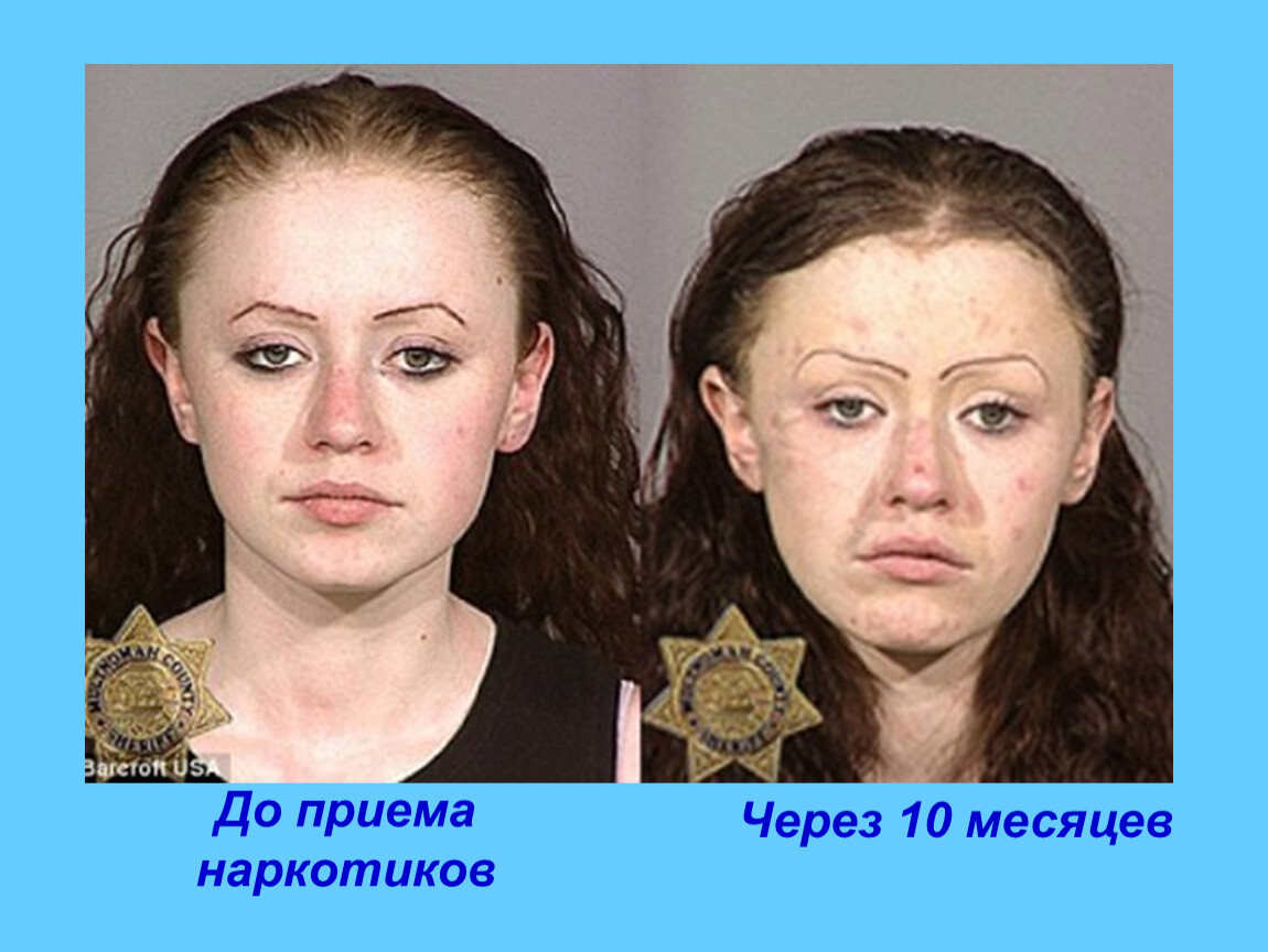 Лицо до и после наркотиков