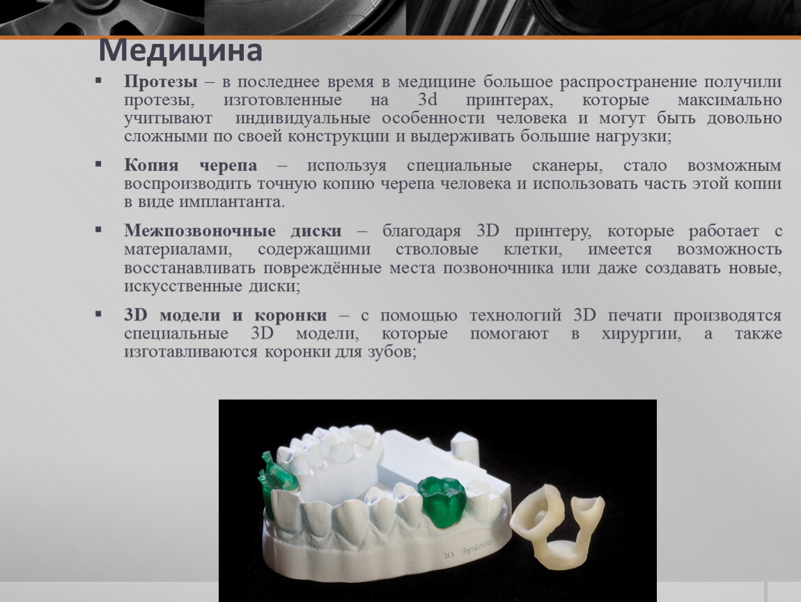 Д технология. 3d технологии в медицине презентация. Протезирование в медицине презентация. Виды 3д принтеров медицинские протезы. Протезирование в медицине кратко.