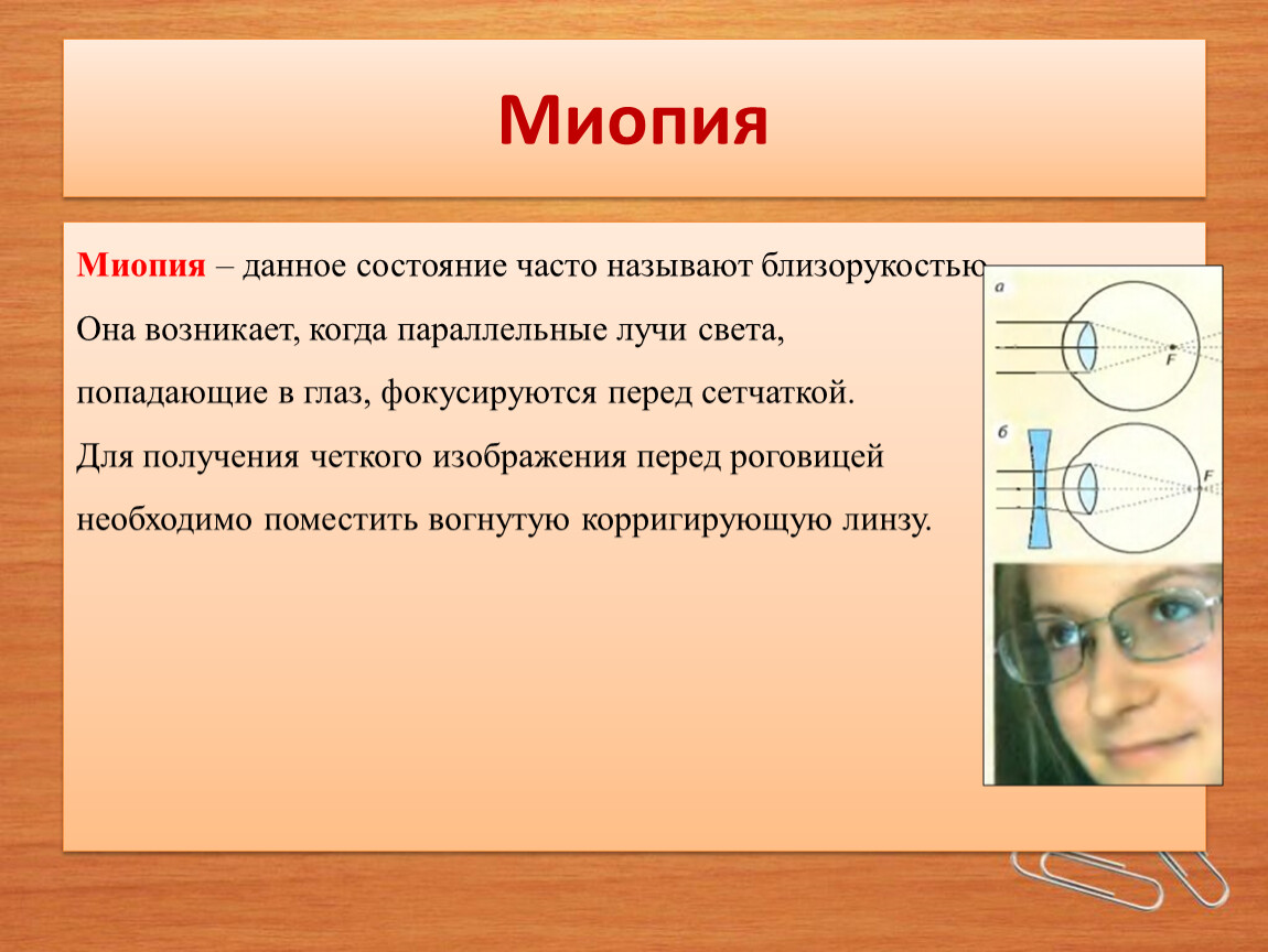 Для получения четкого изображения. Миопия. Что называют близорукостью. При близорукости лучи света фокусируются. Получение четкого изображения.