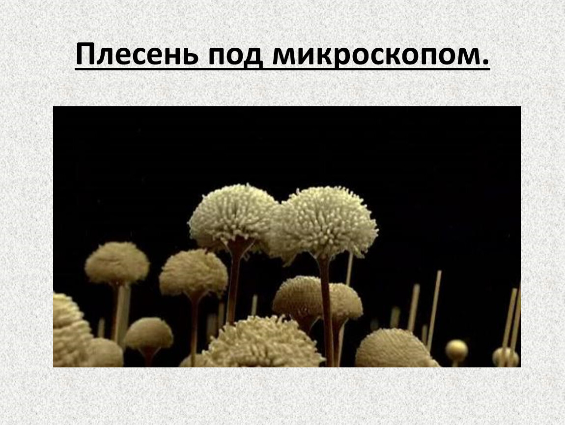 Плесень 2008. Плесневые грибы. Плесень на хлебе под микроскопом. Благородная плесень под микроскопом.