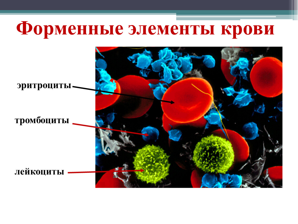 Перечислите элементы крови. Форменные элементы крови эритроциты лейкоциты тромбоциты. Форменные элементы клетки (тромбоциты. Лейкоциты, эритроциты). Таблица форменные элементы крови тромбоциты эритроциты лейкоциты. Форменные элементы крови строение эритроциты.