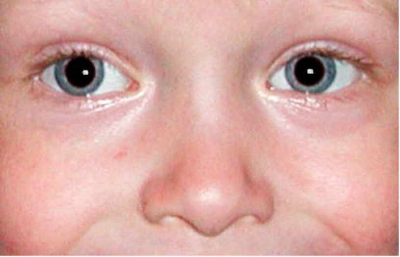 Почему возникает эффект красных глаз на фото