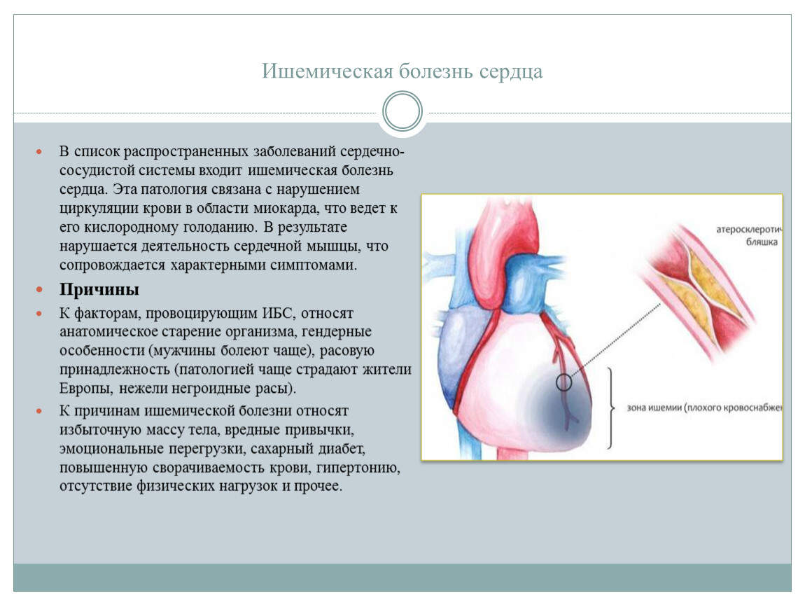 Ишемическая болезнь сердца картинки для презентации