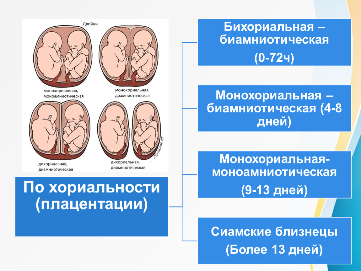 Беременность двойней