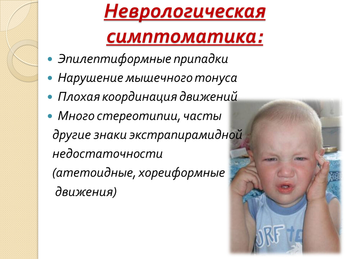 Фенилкетонурия фото у детей
