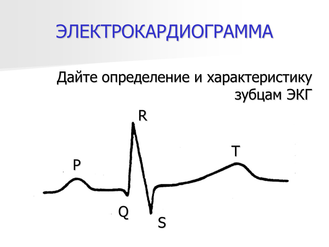 Зубцы экг. ЭКГ зубцы. Зубцы кардиограммы. Характеристика ЭКГ. Зубцы электрокардиограммы.