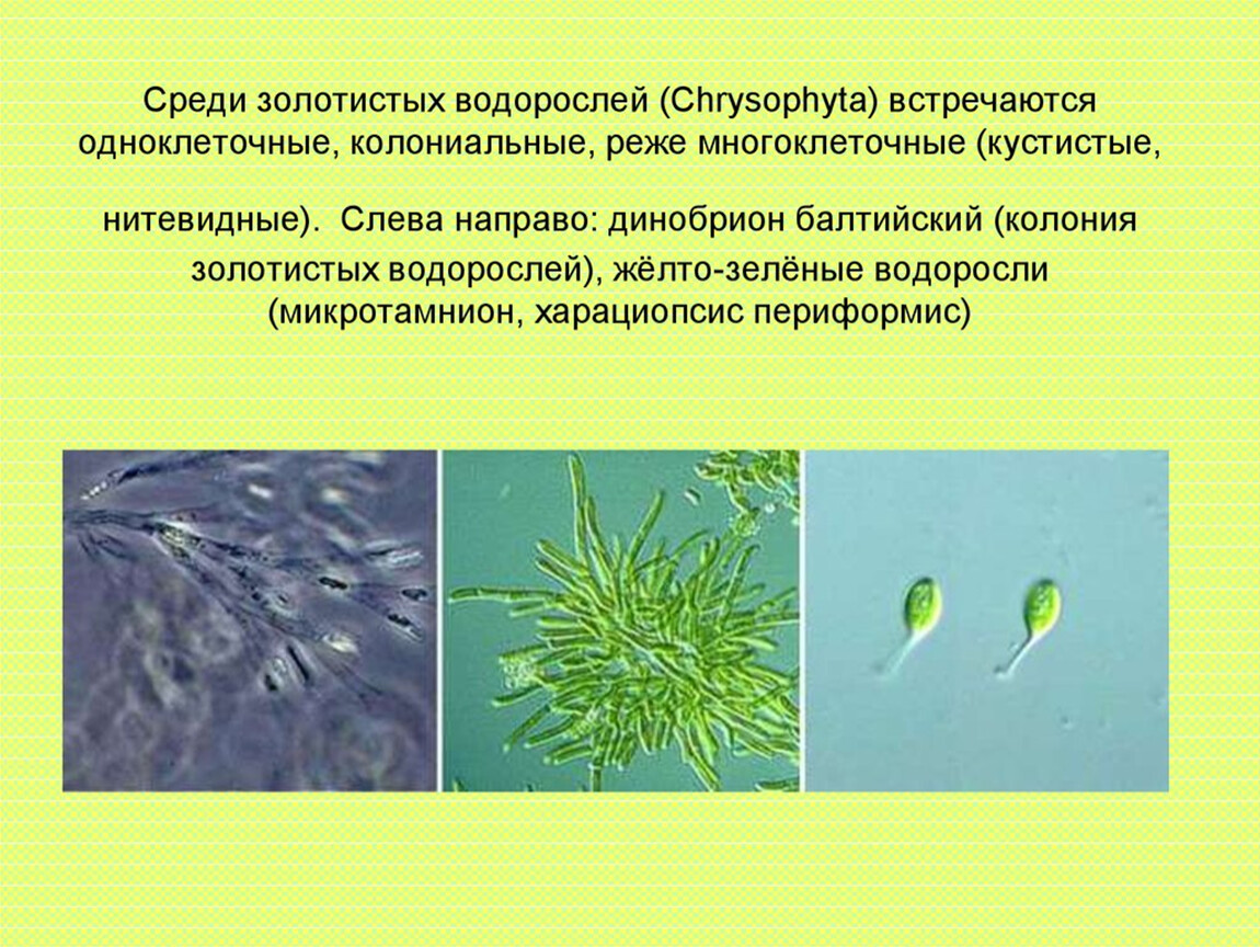 5 примеров водорослей. Отдел золотистые водоросли (Chrysophyta). Динобрион (золотистые водоросли). Золотистые водоросли жгутики. Водоросли одноклеточные колониальные.