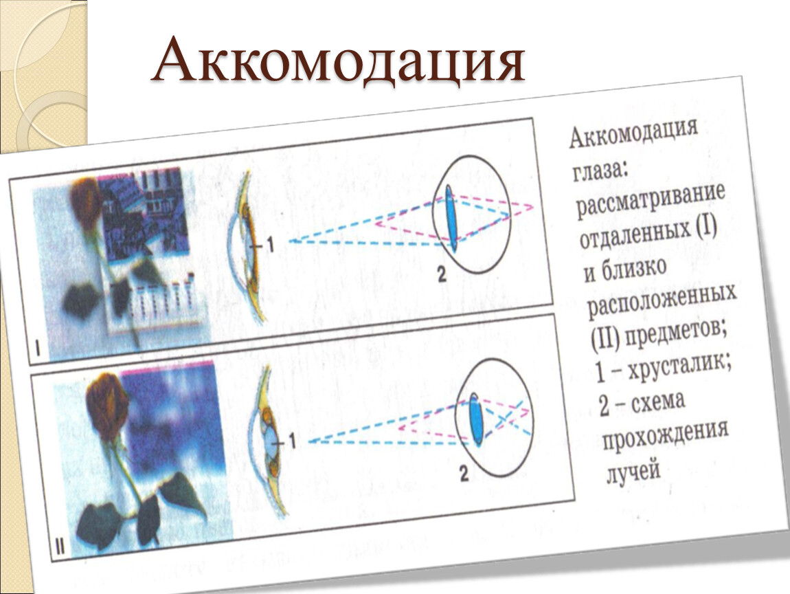 Состояние покоя аккомодации фокус на сетчатке рисунок