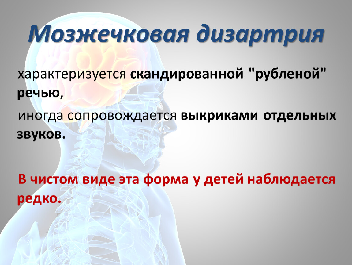 Дизартрия. Мозжечковая форма дизартрии. Мозжечковая дизартрия характеризуется. Дизартрия характеризуется. Дизартрия презентация.