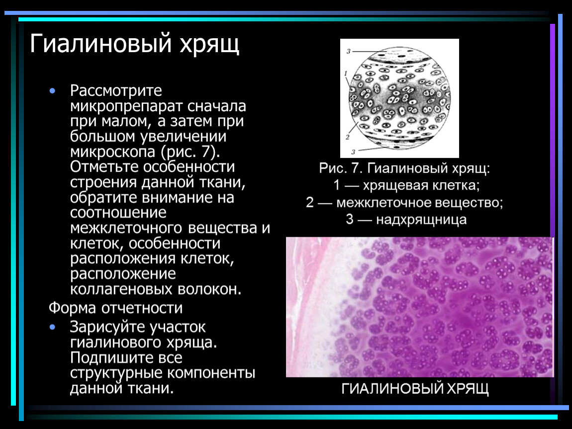 Описании под. Гиалиновый хрящ соединительная ткань функции. Гиалиновый хрящ структурные компоненты. Соединительная ткань гиалиновый хрящ строение. Гиалиновый хрящ ткань строение.