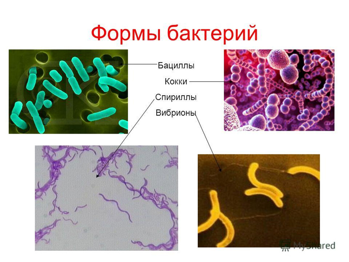 Бактерии человека название. Биология 5 класс кокки вибрионы бациллы. Бактерии бациллы вибрионы. Вибрионы и спириллы. Бактерии вибрионы 5 класс.