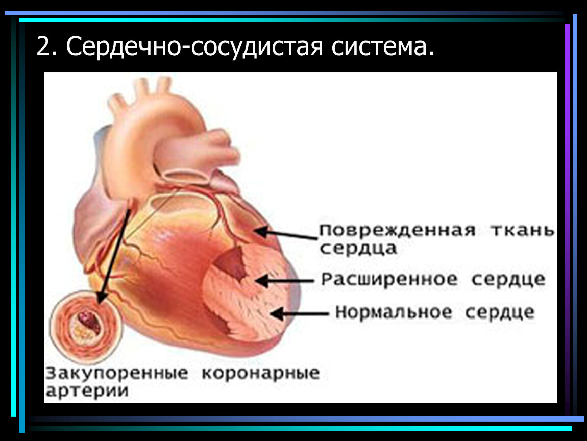 Нормальное состояние. Влияние курения на сердечно сосудистую систему. Влияние никотина на сердечно сосудистую систему человека.