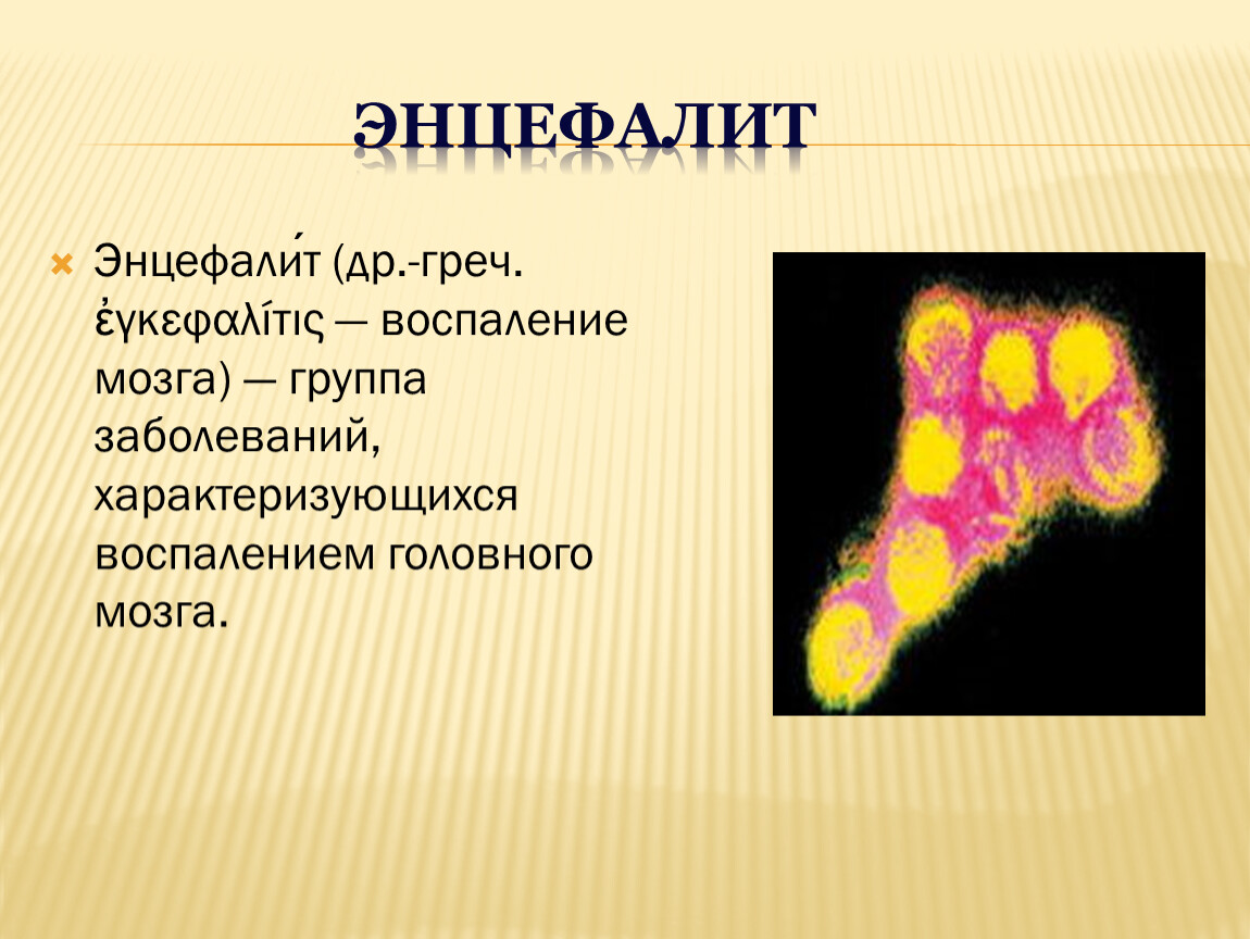 Воспаление мозга. Энцефалит группа заболеваний. Воспаление мозгового вещества.