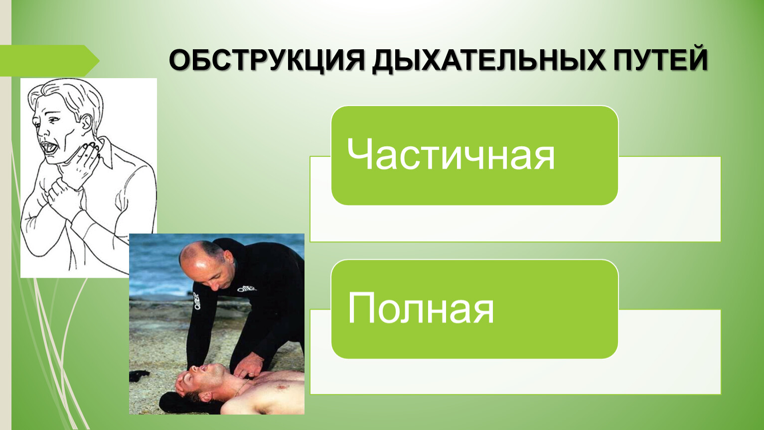 Обструкция дыхательных путей. Виды обструкции дыхательных путей. Частичная обструкция дыхательных путей. Частичная и полная обструкция дыхательных путей.