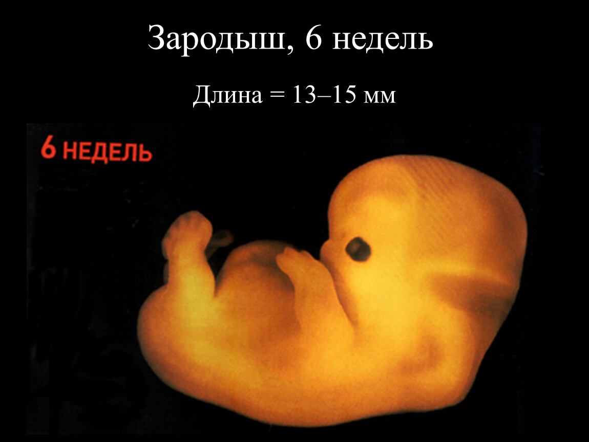 6 эмбриональная неделя. Эмбрион человека 6-7 недель.
