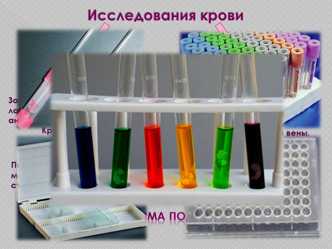 Исследование биологического материала. Забор биологического материала для лабораторного исследования. Лабораторные методы исследования крови животных. Забор биологического материала для бак исследований. Общий анализ крови лабораторная посуда.