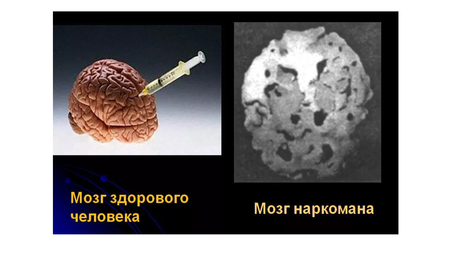 как наркотик влияет на мозг