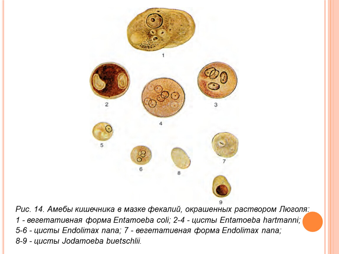 Лечение Entamoeba coli — 4 ответа инфекциониста на вопрос № | СпросиВрача