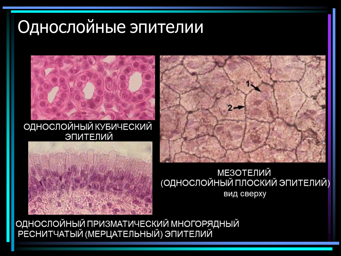 Однослойный мезотелий. Однослойный однорядный плоский эпителий строение. Однослойный призматический эпителий микроскоп. Однослойный однорядный эпителий гистология. Однослойный кубический эпителий гистология.