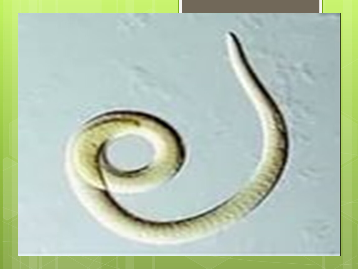 Паразитические черви имеют. Трихинелла круглые черви. Трихинелла фото паразита.