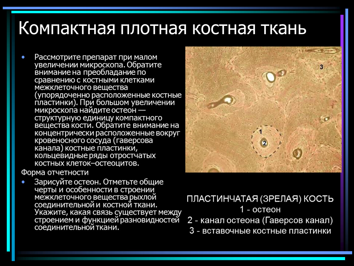 Костная ткань какая. Компактная пластинчатая костная ткань. Пластинчатая (зрелая) костная ткань. Соединительная ткань костная Остеон. Микроскопический препарат костной ткани.