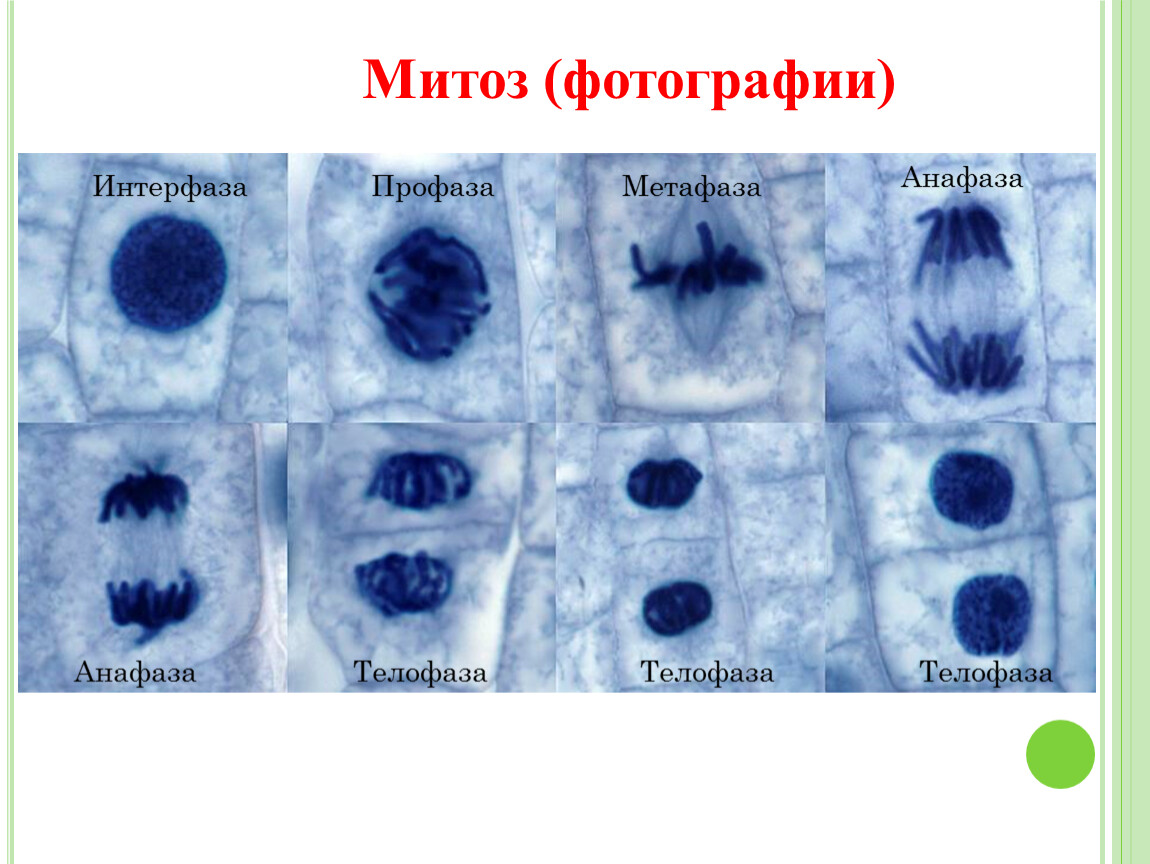 Патологический митоз рисунок