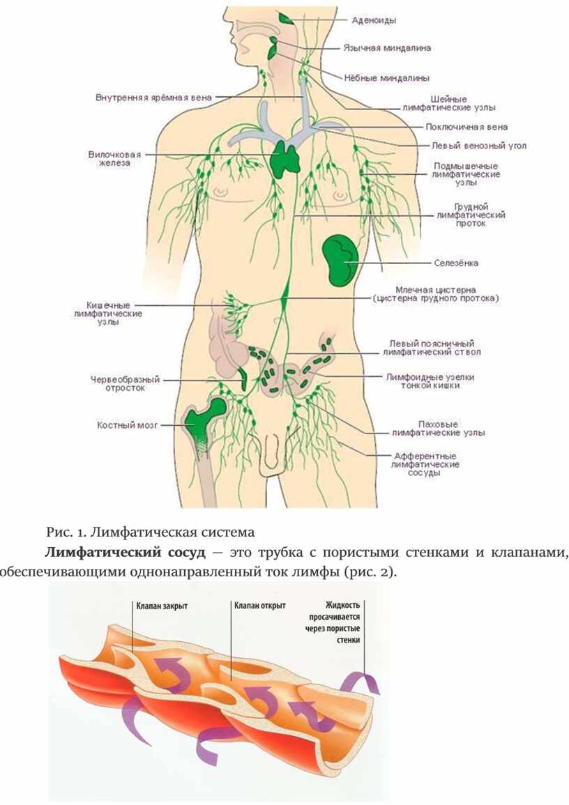 Болезни лимфатической системы таблица