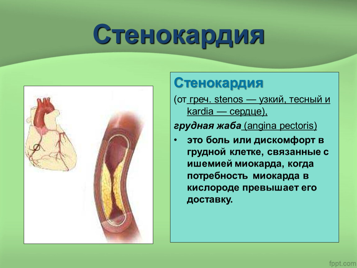 Презентация на тему стенокардия