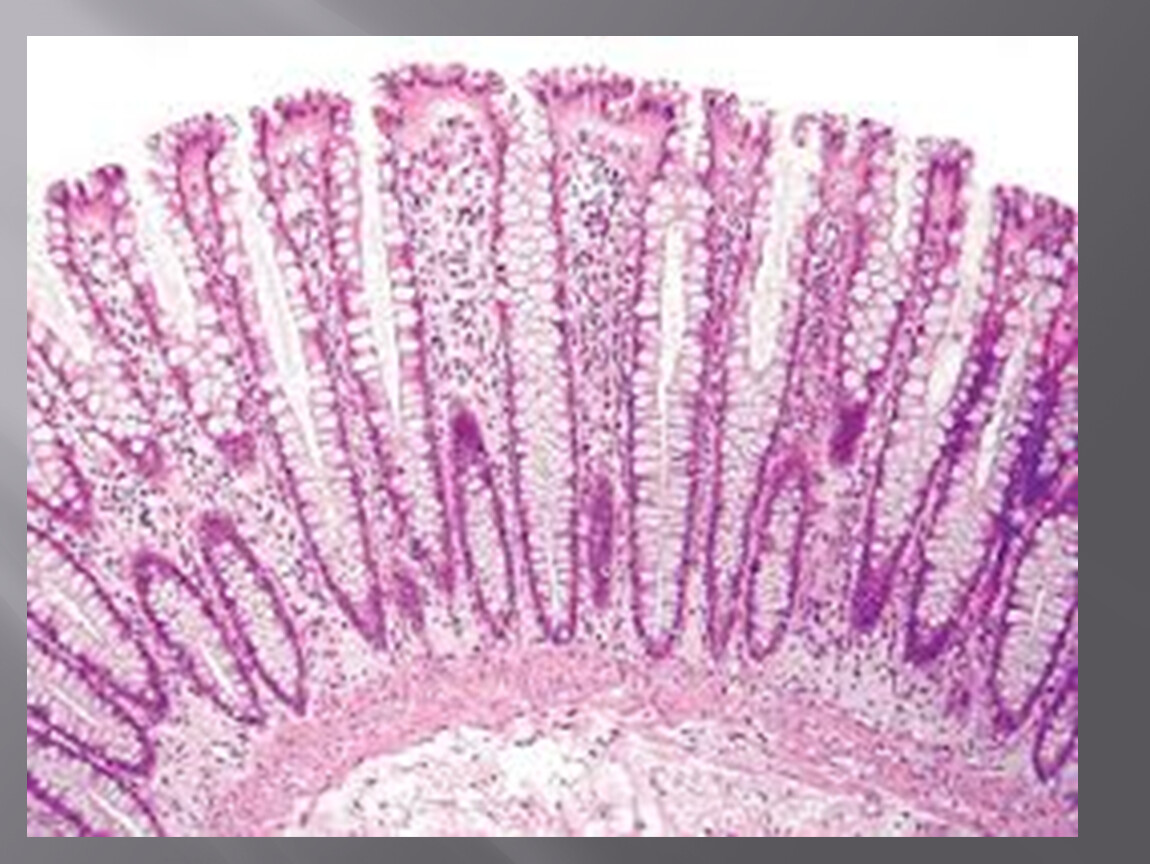 Поверхность слизистой. Эпителий толстой кишки гистология. Толстая кишка гистология препарат. Цилиндрический эпителий гистология. Препарат толстой кишки гистология.