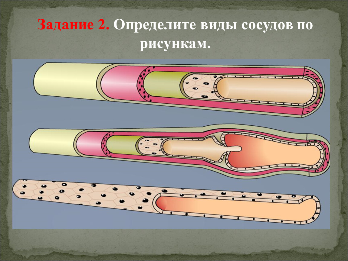 2 определенно. Виды сосудов. Определите типы сосудов:. Определите виды сосудов по рисункам. Задание 2. определите виды сосудов по рисункам..