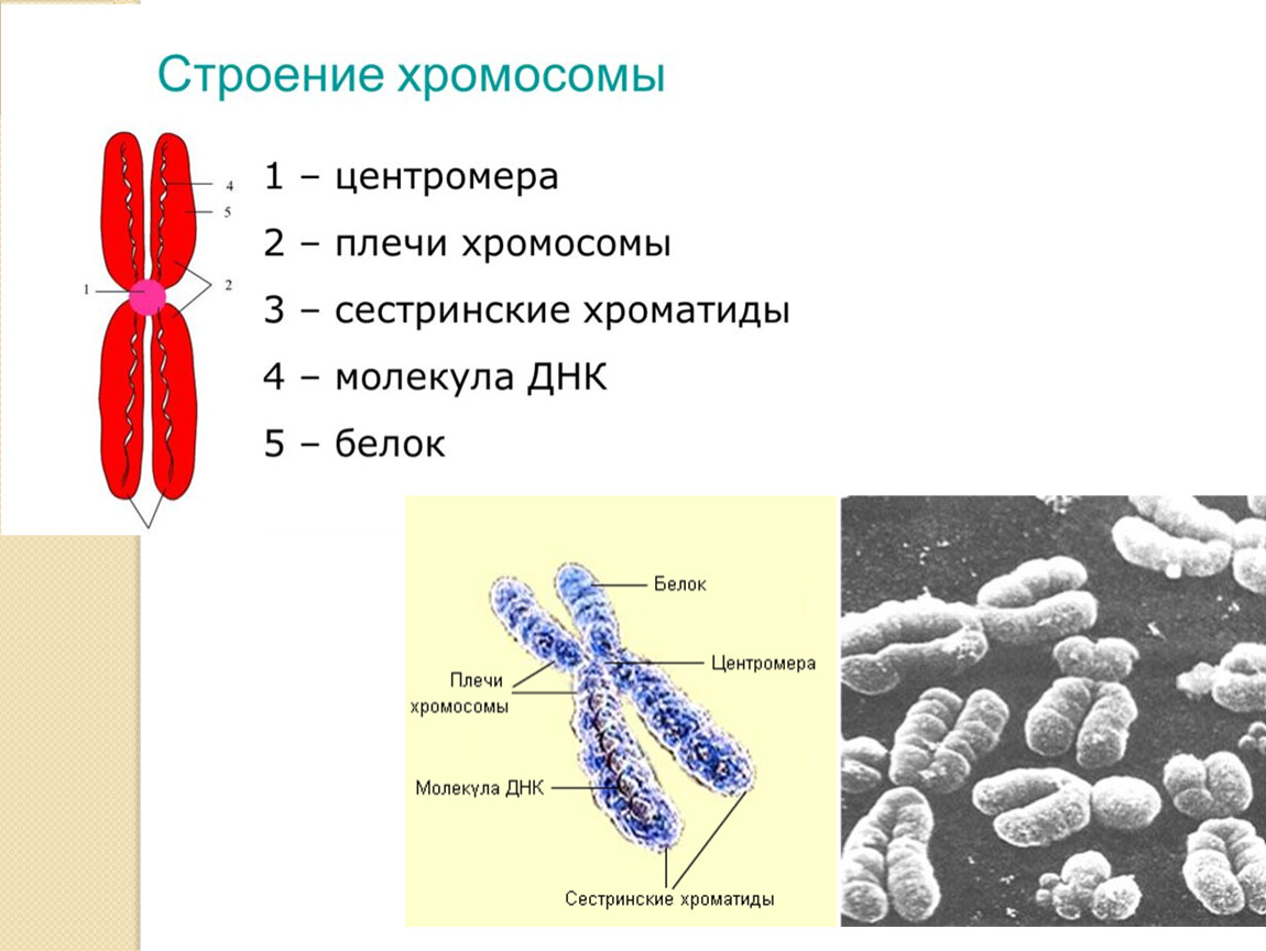 Хромосомы клетки рисунок. Хроматида это центромера это строение хромосомы. Строение хромосомы 9 класс. Строение хромосомы рисунок. Строение хромосомы хроматиды.