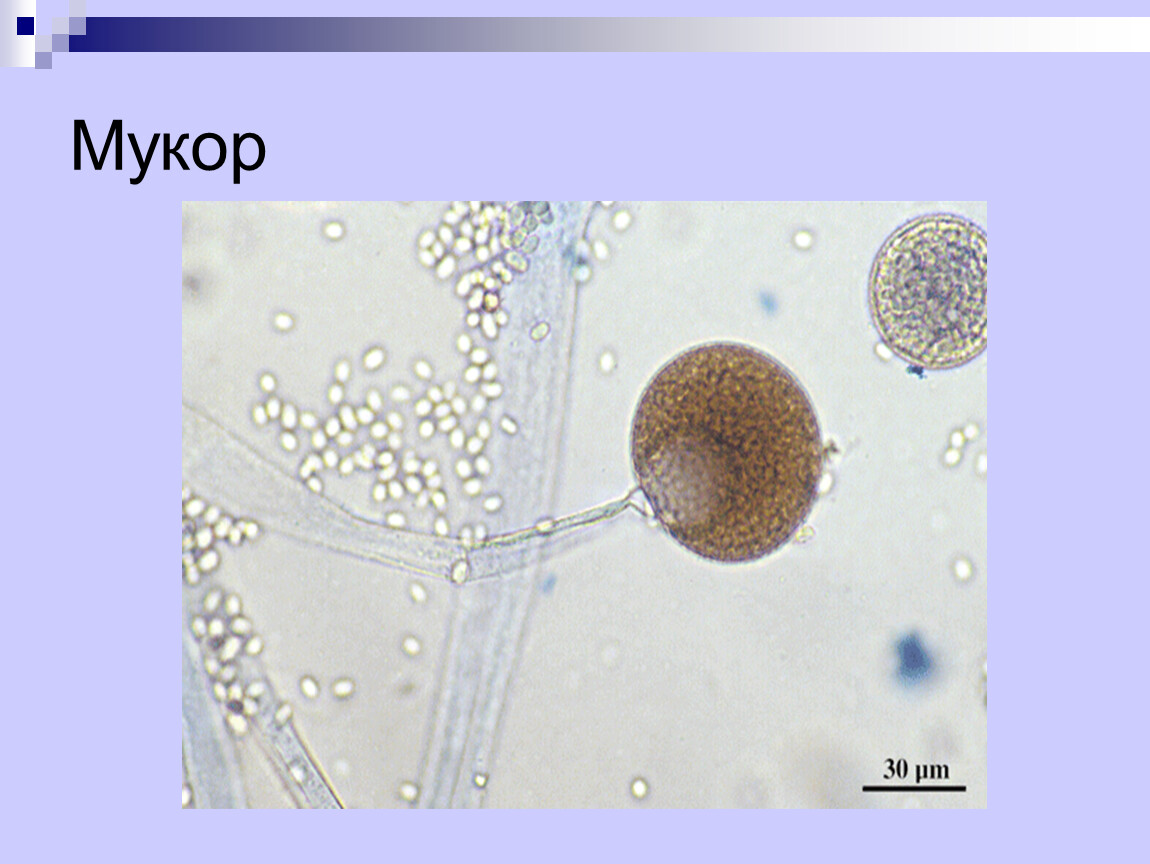 Мукор клетка. Мукор. Клетка мукора под микроскопом. Половые клетки мукора.