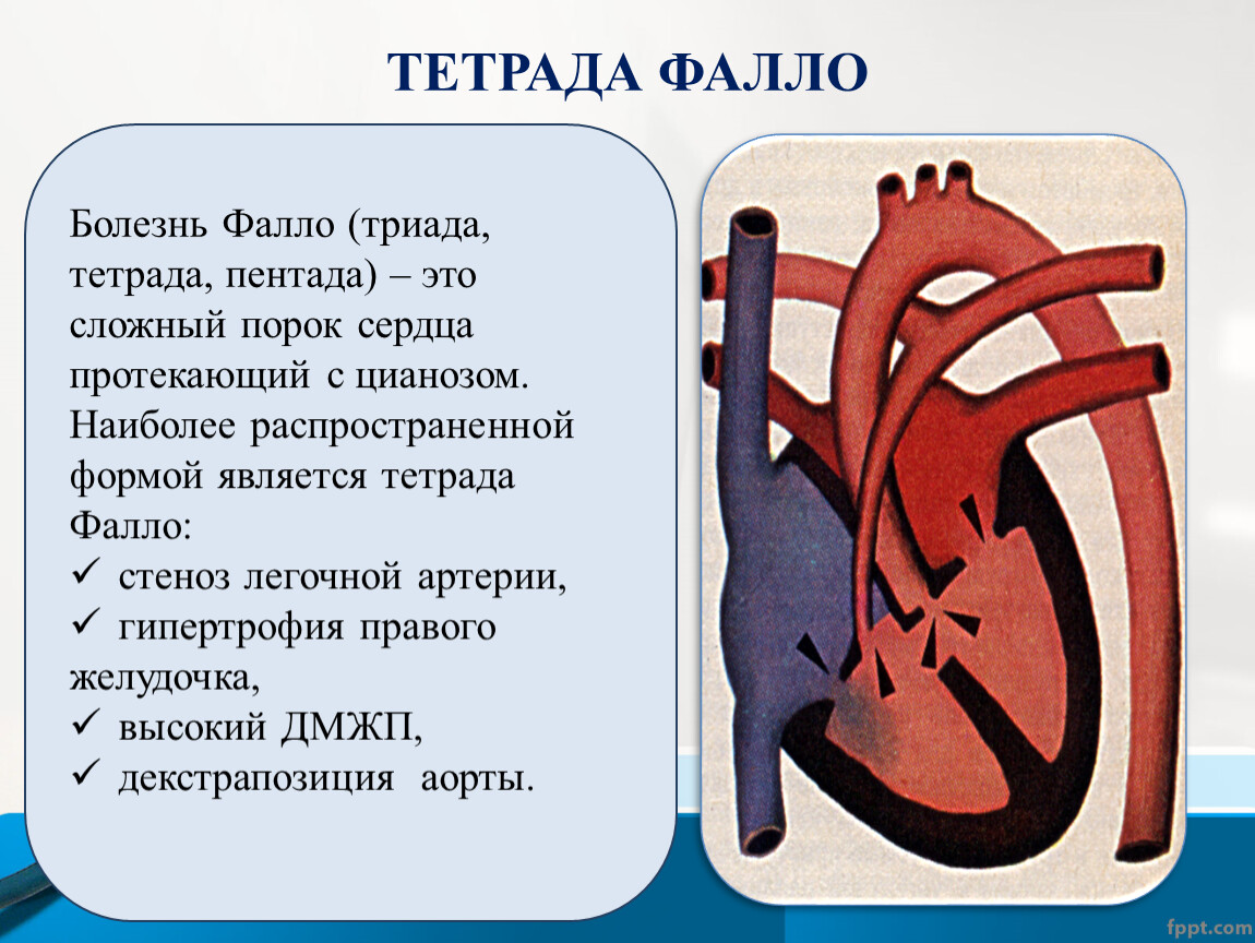 Тетрада фалло это. Триада Фалло гемодинамика. Триада Фалло презентация. Триада Тетрада пентада Фалло.
