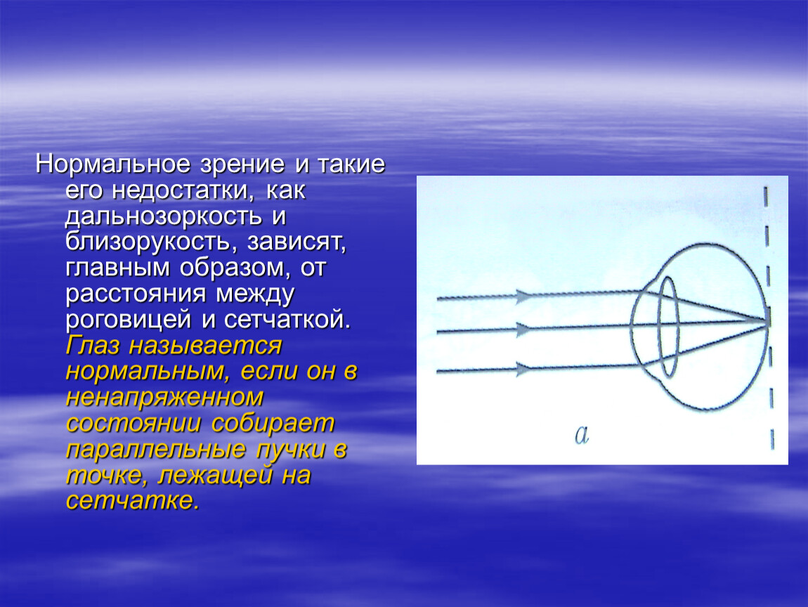 Классы зрения. Дальнозоркость с точки зрения физики. Зрение физика. Близорукость и дальнозоркость физика. Дефекты зрения с точки зрения физики.