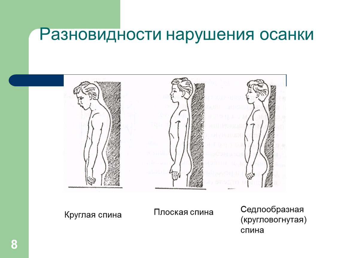 Плоская спина рисунок