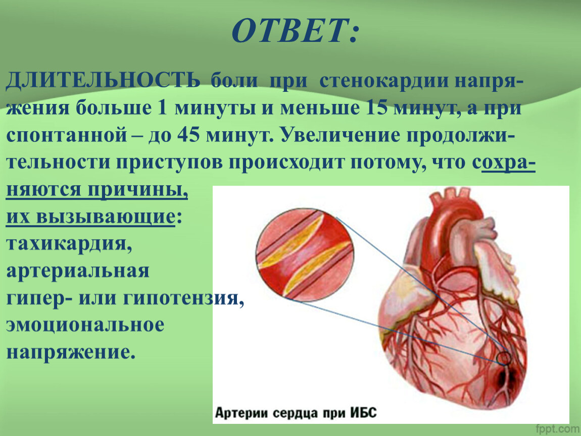 Боль при стенокардии фото